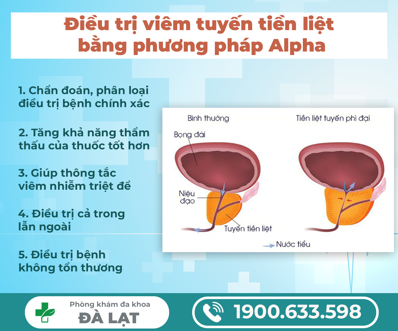 Hình ảnh minh họa